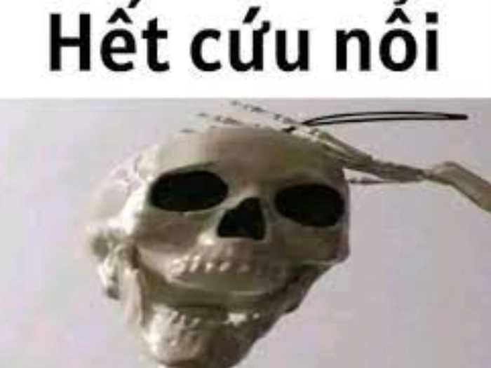 Ảnh meme hết cứu bá đạo khó đỡ